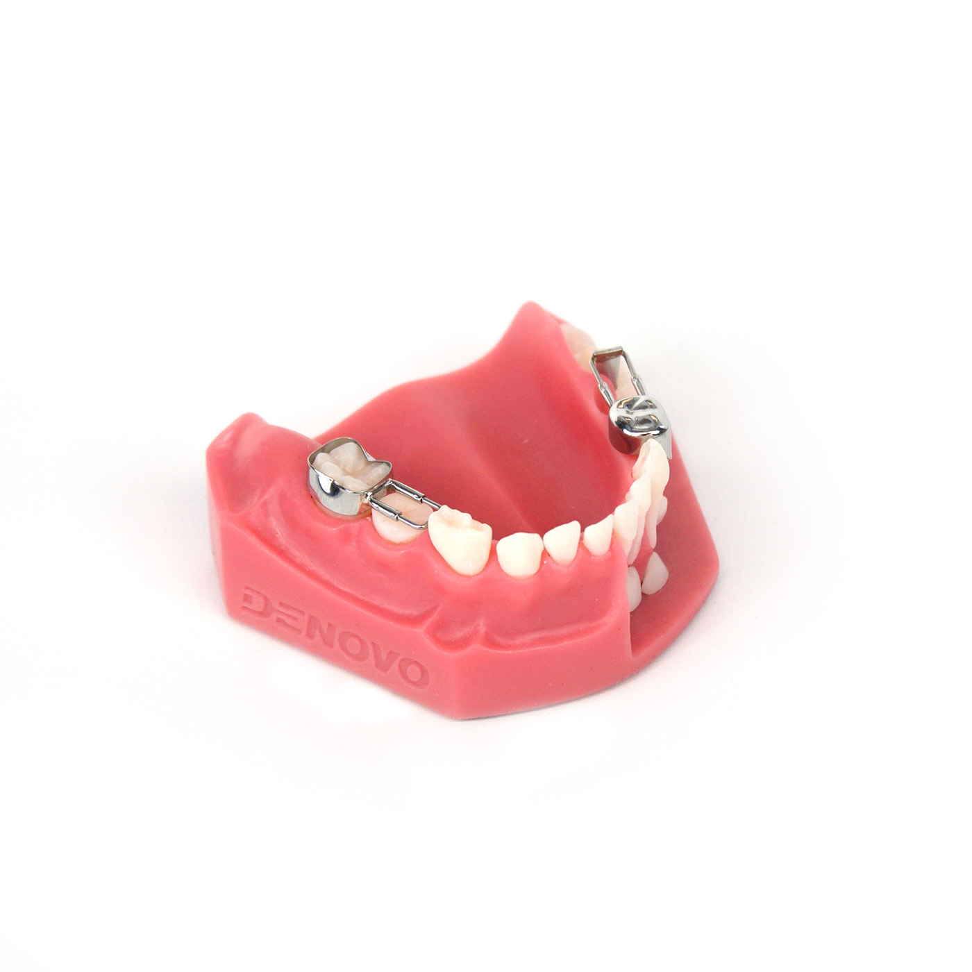 Pediatric Chairside Space Maintainer System — Denovo Dental Denovo Dental